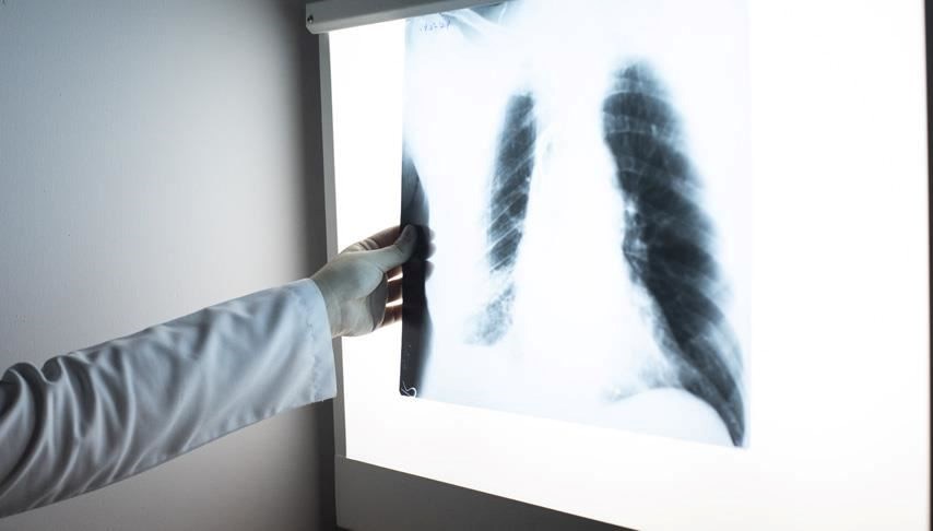 Kanserde tehlikeli artış: Sigara içmeyenlerde de artıyor!